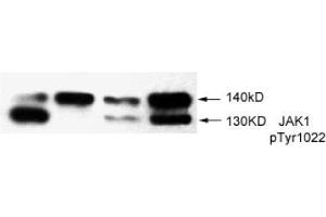 Image no. 2 for anti-Janus Kinase 1 (JAK1) (pTyr1022) antibody (ABIN196869) (JAK1 Antikörper  (pTyr1022))