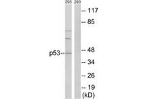 Western blot analysis of extracts from 293 cells, using p53 (Ab-387) Antibody. (p53 Antikörper  (AA 341-390))