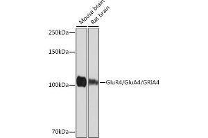 Western blot analysis of extracts of various cell lines, using GluR4/Glu/GRIRabbit mAb (593) at 1:1000 dilution. (GRIA4 Antikörper)