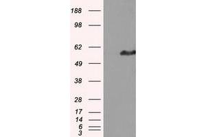 HEK293T cells were transfected with the pCMV6-ENTRY control (Left lane) or pCMV6-ENTRY IFT57 (Right lane) cDNA for 48 hrs and lysed. (IFT57 Antikörper)