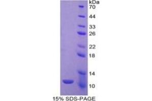 SDS-PAGE (SDS) image for Indoleamine 2,3-Dioxygenase (IDO) ELISA Kit (ABIN6730945)