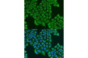 Immunofluorescence analysis of U2OS cells using ATPIF1 antibody. (ATPase Inhibitory Factor 1 Antikörper  (AA 26-106))