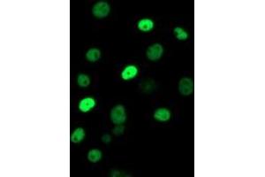 Anti-ERCC1 mouse monoclonal antibody (ABIN2455593) immunofluorescent staining of COS7 cells transiently transfected by pCMV6-ENTRY ERCC1 (RC200478). (ERCC1 Antikörper)