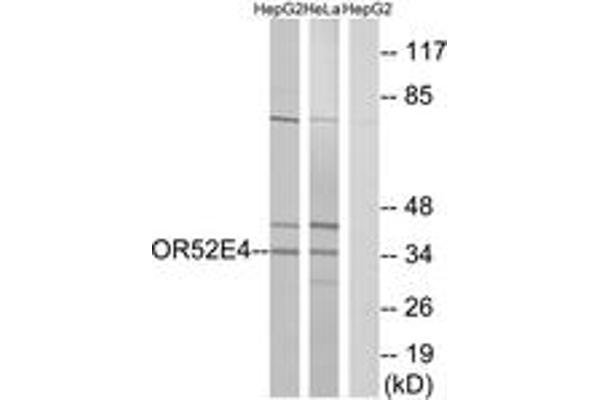 OR52E4 Antikörper  (AA 200-249)