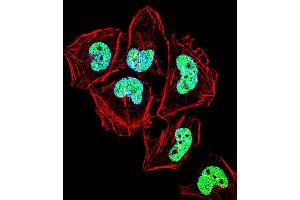 Fluorescent confocal image of Hela cell stained with ZNF155 Antibody . (ZNF155 Antikörper  (C-Term))