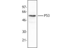 Image no. 1 for anti-Tumor Protein P53 (TP53) (AA 20-25) antibody (ABIN205508) (p53 Antikörper  (AA 20-25))