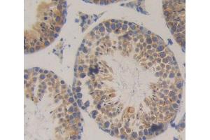 IHC-P analysis of Kidney tissue, with DAB staining. (SRP9 Antikörper  (AA 2-86))