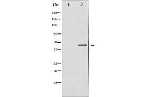 Western blot analysis of p70 S6 Kinase beta expression in 293 whole cell lysates,The lane on the left is treated with the antigen-specific peptide. (RPS6KB2 Antikörper  (C-Term))