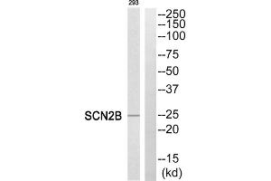 Western blot analysis of extracts from 293 cells, using SCN2B antibody. (SCN2B Antikörper  (Internal Region))