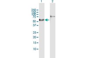 Western Blot analysis of RARA expression in transfected 293T cell line by RARA MaxPab polyclonal antibody. (Retinoic Acid Receptor alpha Antikörper  (AA 1-462))