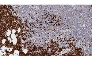 Human thymus: immunohistochemical staining for Terminal Deoxynucleotidyl Transferase. (TdT Antikörper  (N-Term))