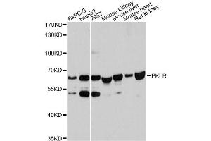 Western blot analysis of extracts of various cell lines, using PKLR antibody. (PKLR Antikörper)