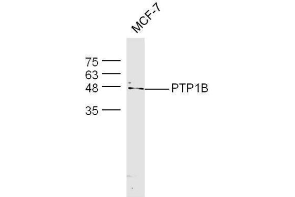 PTPN1 Antikörper  (AA 1-100)