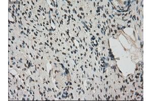 Immunohistochemical staining of paraffin-embedded colon tissue using anti-FERMT2mouse monoclonal antibody. (FERMT2 Antikörper)