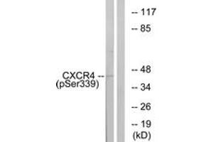 Western blot analysis of extracts from HuvEc cells treated with etoposide 25uM 24H, using CXCR4 (Phospho-Ser339) Antibody. (CXCR4 Antikörper  (pSer339))