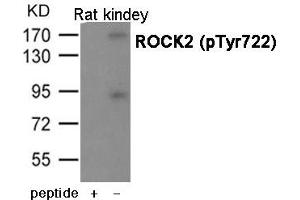 Western blot analysis of extracts from Rat kindey using ROCK2 (Phospho-Tyr722) antibody. (ROCK2 Antikörper  (pTyr722))