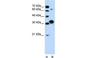 Western Blotting (WB) image for anti-FOS-Like Antigen 1 (FOSL1) antibody (ABIN2460206) (FOSL1 Antikörper)