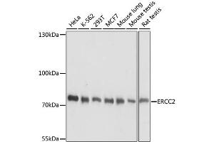 Western blot analysis of extracts of various cell lines, using ERCC2 antibody. (ERCC2 Antikörper)