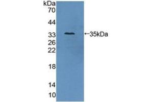 Western blot analysis of recombinant Human AZIN1. (Antizyme Inhibitor 1 Antikörper  (Lys290))