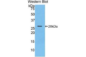 Western blot analysis of the recombinant protein. (PNPLA2 Antikörper  (AA 481-702))