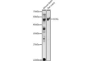 Western blot analysis of extracts of various cell lines, using SOX1 antibody (ABIN3017344, ABIN3017345, ABIN3017346 and ABIN1682856) at 1:1000 dilution. (SOX1 Antikörper)