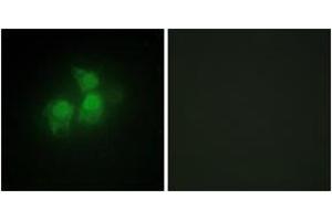 Immunofluorescence analysis of HepG2 cells, using IPPK Antibody. (IPPK Antikörper  (AA 11-60))