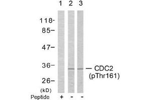 Image no. 2 for anti-Cyclin-Dependent Kinase 1 (CDK1) (pThr161) antibody (ABIN196846) (CDK1 Antikörper  (pThr161))