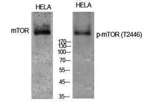 Western Blotting (WB) image for anti-Mechanistic Target of Rapamycin (serine/threonine Kinase) (mTOR) (pThr2446) antibody (ABIN3182280) (MTOR Antikörper  (pThr2446))