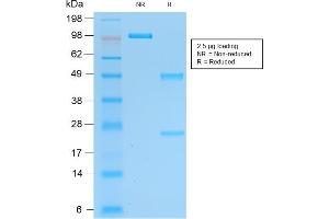 SDS-PAGE (SDS) image for anti-Ubiquitin Carboxyl-terminal Esterase L1 (Ubiquitin Thiolesterase) (UCHL1) antibody (ABIN6940856)