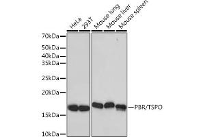Western blot analysis of extracts of various cell lines, using PBR/TSPO Rabbit mAb (ABIN1679051, ABIN3019258, ABIN3019259 and ABIN7101738) at 1:1000 dilution. (TSPO Antikörper)