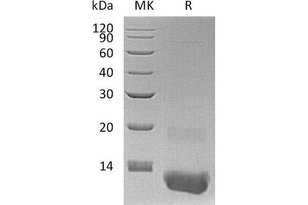 CXCL3 Protein (His tag)