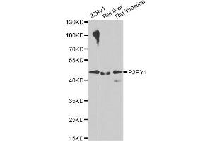 Western blot analysis of extracts of various cell lines, using P2RY1 antibody. (P2RY1 Antikörper)