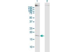 Western Blot analysis of CMTM5 expression in transfected 293T cell line ( H00116173-T01 ) by CMTM5 MaxPab polyclonal antibody. (CMTM5 Antikörper  (AA 1-156))