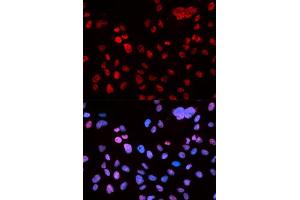 Immunofluorescence analysis of U2OS cell using Phospho-TP53-S9 antibody. (p53 Antikörper  (pSer9))