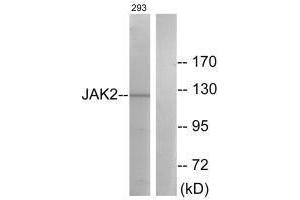 Western blot analysis of extracts from 293 cells, treated with etoposide (25uM, 24hours), using JAK2 (Ab-570) antibody. (JAK2 Antikörper  (Tyr570))