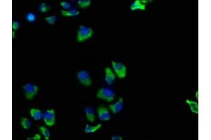 Immunofluorescence staining of Hela cells with ABIN7173872 at 1:100, counter-stained with DAPI. (TNFRSF1A Antikörper  (AA 249-455))