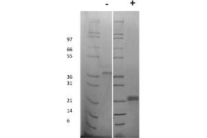 SDS-PAGE of Rat Vascular Endothelial Growth Factor-165 Recombinant Protein SDS-PAGE of Rat Vascular Endothelial Growth Factor-165 Recombinant Protein. (VEGF 165 Protein)