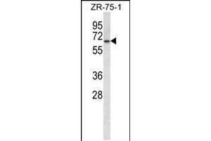 Western blot analysis in ZR-75-1 cell line lysates (35ug/lane). (GPD2 Antikörper  (C-Term))