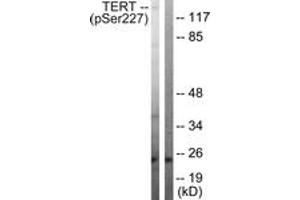Western Blotting (WB) image for anti-Telomerase Reverse Transcriptase (TERT) (AA 196-245), (pSer227) antibody (ABIN482341) (TERT Antikörper  (pSer227))