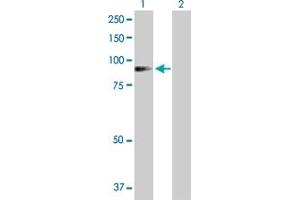 Western Blot analysis of ADD1 expression in transfected 293T cell line by ADD1 MaxPab polyclonal antibody. (alpha Adducin Antikörper  (AA 1-662))