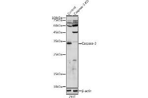 Western blot analysis of extracts from normal (control) and Caspase-3 knockout (KO) 293T cells, using Caspase-3 antibody (ABIN6131582, ABIN6137962, ABIN6137964 and ABIN6215049) at 1:1000 dilution. (Caspase 3 Antikörper  (AA 55-160))
