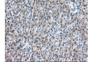 Immunohistochemical staining of paraffin-embedded Human colon tissue using anti-USP5 mouse monoclonal antibody. (USP5 Antikörper)