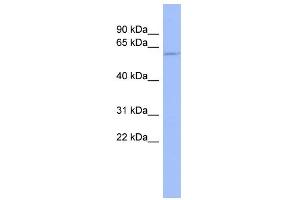 WB Suggested Anti-TPTE Antibody Titration:  0. (TPTE Antikörper  (Middle Region))