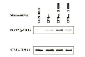 Induction of phosphorylation of STAT 1 at Ser727 in human malignant melanoma cells (short-term culture derived from a patient) in response to interferons. (STAT1 Antikörper  (pSer727))