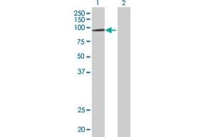 Lane 1: HIRA transfected lysate ( 111. (HIRA 293T Cell Transient Overexpression Lysate(Denatured))