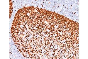 IHC testing of human human tonsil stained with PCNA antibody (PC10). (PCNA Antikörper)