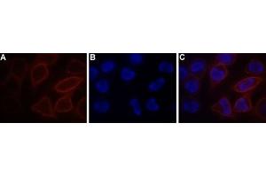 Expression of STIM1 in RBL cells - Cell surface detection of STIM1 in live RBL cells. (STIM1 Antikörper  (Extracellular, N-Term) (Atto 550))