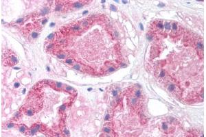 Human Kidney (formalin-fixed, paraffin-embedded) stained with HNF4A antibody ABIN214775 at 5 ug/ml followed by biotinylated goat anti-rabbit IgG secondary antibody ABIN481713, alkaline phosphatase-streptavidin and chromogen. (HNF4A Antikörper  (N-Term))