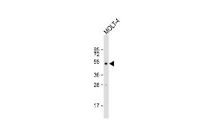 Anti-DENND1B Antibody (N-term) at 1:500 dilution + MOLT-4 whole cell lysate Lysates/proteins at 20 μg per lane. (DENND1B Antikörper  (N-Term))