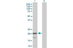 Western Blot analysis of CD3D expression in transfected 293T cell line by CD3D MaxPab polyclonal antibody. (CD3D Antikörper  (AA 1-171))